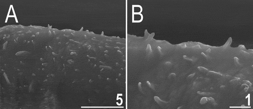 Figure 19. Dorsal sculpturing of Echiniscoides trichosus sp. nov. in close-up (SEM). Scale bars in μm.