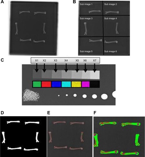 Figure 2 Stages involved in the measurement of bone mass density using X-ray morphometry and edge detection technique in ovariectomized rats treated with germinated brown rice and its bioactives, estrogen, or Remifemin® for a period of 8 weeks.