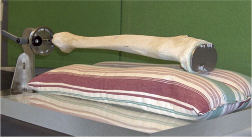 Figure 2. The human phantom bone fixed in neutral flexion on a retrograde nail in a clamp, allowing adjustment of flexion and rotation. Because the scans were made with a “spine program”, we used nylon boards and 2 long rice bags to imitate the soft tissues of the abdomen and loin.