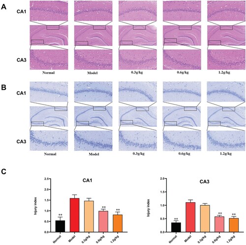 Figure 3. Effects of ACB on morphology and structure of hippocampus of PTZ kindled rats. (A) H&E staining (100× and 400×). (B) Nissl staining (100x and 400x). (C) statistical charts for injury index. **p < 0.01, vs. model group.