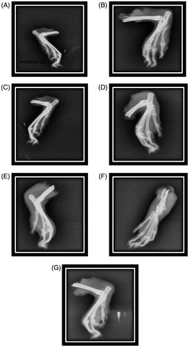 Figure 2. Radiographs of hind legs in adjuvant-induced arthritic rats. (A) Group I normal control; (B) group II negative control; (C) group III positive control; (D) group IV ESBCI (28 days treatment); (E) group V ESCI (28 days treatment); (F) group VI ESBCI (14 days treatment); (G) group VI ESCI (14 days treatment).