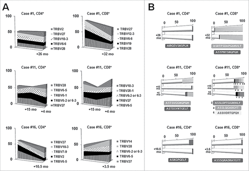 Figure 3. Longitudinal analysis in three selected MBL cases for the CD4+ and CD8+ T cell fractions. Gene frequencies (A) were assessed considering clonotypes whereas clonality (B) was measured considering rearrangements. A, TRBV gene repertoire dynamics over time. Only the five most frequent genes are represented. Sequential time points are indicated in the x-axis whereas the frequency (%) of each gene is shown in the y-axis. B, Clonal fluctuations over time. Each horizontal bar illustrates a different time point. White cylindrical parts of the bars account for the different clonotypes among the distinct time points whereas darker cubic parts represent persistent clonotypes. The frequency (%) of each clonotype is shown along the x-axis. Clonotypes shared by different time points, as well as their CDR3 amino acid sequence, are depicted in the same color.