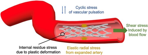 Figure 2. Schematic of the biomechanical environment of a stent in a blood vessel.