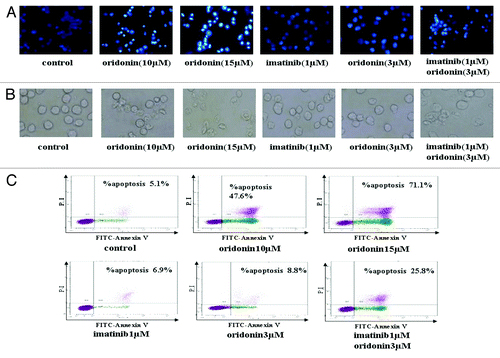 Figure 2. Oridonin and imatinib induced apoptosis in SUP-B15 cells. (A) The SUP-B15 cells were treated with indicated oridonin, imatinib, or combination for 24 h, changes in cellular morphology were examined by a light microscope. The membrane of control cells was lubricious and integrity, treatment of 3 μM oridonin, 1 μM imatinib showed little morphologic changes, but oridonin plus imatinib-treated cells showed bluffing and lobulate appearances of membrane ( × 400). (B) The cells were treated with indicated oridonin, imatinib or in combination for 24 h, then stained with hoechst 33258 fluorescent. Changes in cellular nuclei were observed under a fluorescence microscope. The nuclei of control cells were round and were homogeneously stained. Treatment of 3 μM oridonin, 1 μM imatinib showed little morphologic changes, similar to control cells, while oridonin plus imatinib-treated cells showed marked blebbing of the nuclei and apoptotic bodies ( × 200). (C) The cells were treated with indicated oridonin, imatinib or in combination for 24 h and apoptosis was examined using the AnnexinV-FITC /PI apoptosis detection kit.