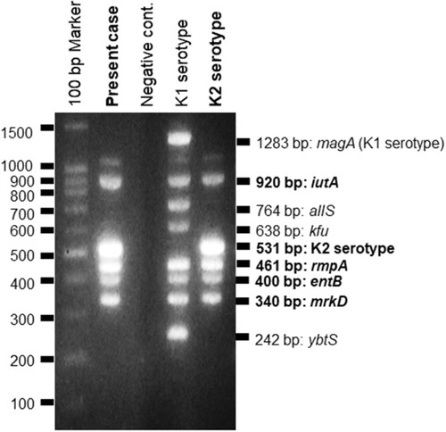 Figure 2 Multiplex PCR. The present strain harbored iutA, rmpA, entB, and mrkD genes.