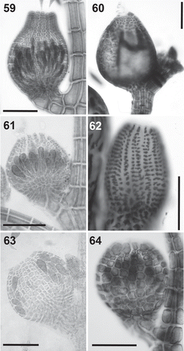 Figs 59–64. Cystocarps in the Polysiphonieae. Urceolate in Polysiphonia stricta (Fig. 59, Polysiphonia sensu stricto clade 1). Ovoid in Vertebrata lanosa (Fig. 60, Vertebrata clade), P. denudata (Fig. 61, Carradoriella clade), Streblocladia glomerulata (Fig. 62, Streblocladia clade). Globose in Polysiphonia schneideri (Fig. 63, ‘P.’ schneideri clade) and Neosiphonia collabens (Fig. 64, Melanothamnus clade). Scale bars: Figs 59–62 and 64, 200 µm; Fig. 63, 100 µm.