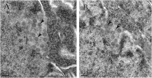 Fig. 4 Transmission electron micrographs of infected rat brain tissues.a, b CoV-like particles are considered SL-CoVs ZC45 in different locations of the infected rat brain tissues