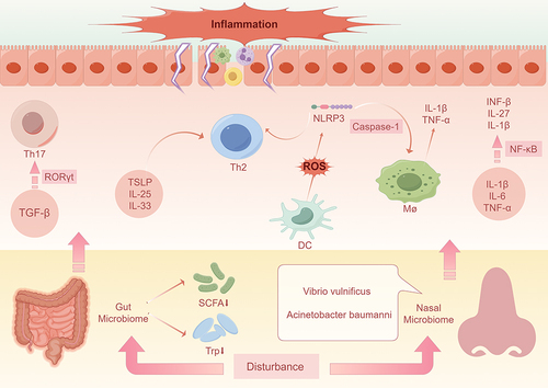 Figure 1 Impact of gut and nasal microbial dysbiosis on AR. Disturbance of the gut microbiota and a decrease in intestinal metabolites (eg, short-chain fatty acids and tryptophan,) induces the production of TSLP, IL-25, and IL-33, which contributes to Th2 cytokine production and promotes localized inflammatory responses. It also creates an environment rich in transforming growth factor-β, which promotes cellular differentiation toward pro-inflammatory Th17 by increasing the amount of RORγ-t. Vibrio traumaticus in the nasal cavity induces cytokines such as IL-1β, IL-6, and TNF-α, participates in NF-κβ signaling, and elicits allergic reactions by releasing IFN-β, IL-27, and IL-1β. A. baumannii activates the Nod-like receptor NLRP3 via caspase-1, which promotes the release of IL-1β and TNF-α from macrophages, thereby triggering AR. In addition, A. baumannii induces the production of reactive oxygen species from dendritic cells, which activates NLRP3 and promotes the differentiation of cells towards pro-inflammatory Th2, triggering the immune response typical of AR.