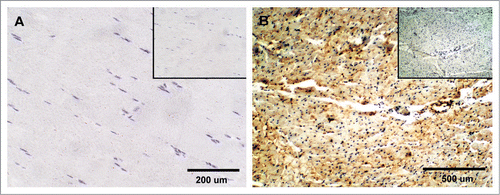 Figure 5 Expression of PrPC in bovine striated and cardiac muscle. (A) No immunoreactivity for PrPC was detected in semitendinosus striated muscle after incubation with SAF-32 antibody. (B) PrPC labeling was observed in unidentified structures outside the cardiac muscle fibers; labeling was not observed in cardiac muscle cells of the myocardium. Inserts represent serial section incubated with non-immune horse serum instead of SAF-32 antibody (negative control).