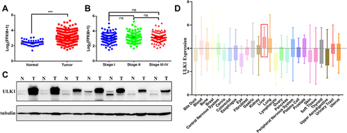 Figure 1 ULK1 is overexpressed in HCC tissues and cell lines. (A) Data from TCGA showing normalized mRNA expression of ULK1 in liver cancer tissues and normal tissues. ***P < 0.001. (B) Comparison of normalized mRNA level among stage I HCC, stage II and stage (III–IV) HCC samples. (C) Protein expression of ULK1 in HCC tissues and adjacent non-tumor tissues was detected by immunoblot. (D) ULK1 expression in human cancer cell lines originating from different tissues or organs was analyzed using online tool CCLE.
