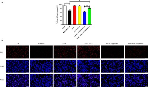 Figure 3. demonstrates that upregulation of PLAGL2 can attenuate the inhibitory effect of hyperoxia on AECII cell proliferation. (A) CCK-8 assay showed that the proliferation capacity was restored in the Ad – PLAGL2 + HYPEROXIA group compared to the HYPEROXIA group. (B) EDU assay was performed to assess cell proliferation, and it revealed enhanced proliferation ability of AECII cells after upregulating PLAGL2. Statistical significance was determined as *p < 0.05, **p < 0.01, ***p < 0.001.