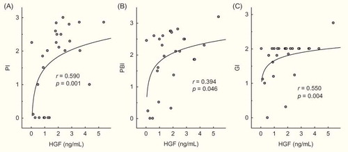 Figure 5.  HGF levels in saliva and periodontal status indices in patients with PD. (A) PI; (B) PBI; and (C) GI.