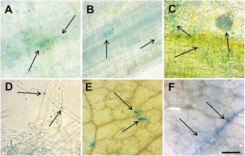 Figure 4. Light microscopy for histochemical GUS signal localization in М. truncatula pGRAS::GUS-GFP transcriptional reporter plants after salinity stress with 50 mmol L−1 NaCl. Signal detection in root epidermal cells (A and B), root hairs (C and D), leaf epidermal cells (E and F). Scale bar = 0.50 to 3 cm.