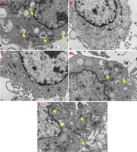 Figure 9 The effect of ZgI-AuNPs on the autophagy of HSCS cells. The red labeling of “N” represents the cell nuclear, the “Mi” represents the mitochondria and the “RER” represents the rough endoplasmic reticulum. The yellow arrows represents the autophagosomes. (A).Normal group: saline + RPMI 1640. (B). Model group: CTX + RPMI 1640. (C). AuNPs group: CTX + AuNPs. (D). ZgI group: CTX + ZgI. (E). ZgI-AuNPs group: CTX +ZgI- AuNPs.