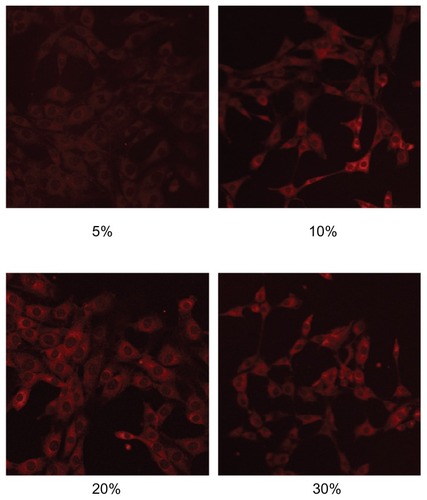 Figure 9 LSCM images showing different concentrations of rhodamine B-labeled microemulsion incubated with mouse skin fibroblasts.Abbreviation: LCSM, laser scanning confocal microscopy.