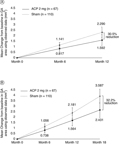 Figure 3. GATHER1 efficacy outcomes for ACP 2-mg cohort compared with sham. Mean change in observed geographic atrophy (GA) area from baseline (A) through 12 months and (B) through 18 months. Least squares (LS) means based on estimates from a mixed-effects repeated measures (MMRM) model on available intention-to-treat (ITT) populations, up to Month 12 data for A and up to 18 month for B.