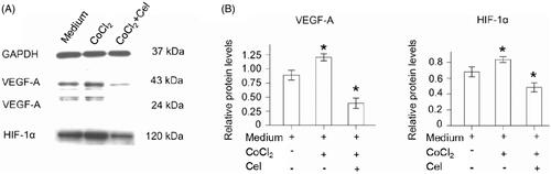 Figure 4. CNMs suppress hypoxia-inducible VEGF-A and HIF-1α protein expression in EA.hy 926.7 cells treated with CoCl2. EA.hy 926.7 cells were incubated in the presence or absence of 27.2 µg/mL CNMs for 24 hours under normal or hypoxic (CoCl2) conditions. VEGF-A and HIF-1α protein levels were detected by western blotting. (A) shows one representative western blot of three independent experiments. (B) show the relative protein levels and the statistical analysis results (mean values ± SD). cytosolic and nuclear fractions under normal conditions without CNMs were set as 1, *p < 0.05.