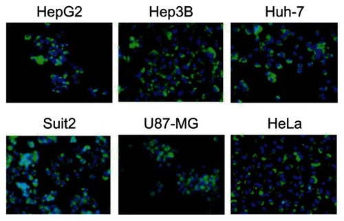 Figure 3 Uptake of HspG41C–Alx cages by cancer cell lines.Notes: Cells were incubated with 40 nM of HspG41C (1 μM of protein monomer unit) for 24 hours and observed by fluorescence microscopy. Green indicates HspG41C–Alx cages; blue indicates the nuclei.Abbreviations: HspG41C, mutant heat shock protein cage; HspG41C–Alx, fluorophore (Alexa Fluor® 488)-labeled HspG41C cage.