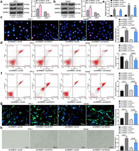 Figure 7. GATA1 or HDAC2 overexpression counteracts the inhibitory effect of oe-NRBP2 on TC cells. A-B, protein level of NRBP2 in TPC-1 (a) and CAL62 (b) cells after GATA1 or HDAC2 overexpression, respectively, examined by western blot assays; (c), proliferation activity of TPC-1 and CAL62 cells examined by the EdU labeling assay; (d), apoptosis rate in TPC-1 and CAL62 cells determined by flow cytometry; (e), IL-6 and VEGFA concentrations in TPC-1 and CAL62 cell secretions examined using ELISA kits; (f)-(g), polarization of M2 macrophages cells co-cultured with TPC-1 and CAL62 cells determined by flow cytometry and immunofluorescence staining; (h), angiogenesis ability of HUVECs co-cultured with TPC-1 and CAL62 cells determined by tube formation assay. Three repetitions were performed. **p < 0.01.