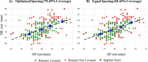 Figure 7. Population coverage (in terms of maximum OUH values of <3mm) for four femur component sizes with optimised spacing (A) and equal spacing (B).