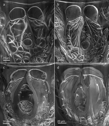 Figure 6. Scanning electron microscopy (SEM) images of the scutellum of (a) female Rhoptromeris dichromata sp. nov., (b) female R. koponeni sp. nov., (c) male R. leptocornis sp. nov., and (d) female R. macaronesiensis sp. nov.