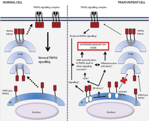 Figure 2. Model of signalling and trafficking pathways for wild-type and mutant TNFR1 in normal cells and cells from TRAPS patients. Wild-type receptors traffic from the endoplasmic reticulum (ER) through Golgi to the cell surface, allowing normal TNF-α-induced signalling. In cells from patients with TRAPS, mutant TNFR1s are retained in the ER (Citation39,Citation50,Citation51), where they may activate signalling pathways on their own or by inducing ER stress, leading to an unfolded protein response (UPR) (Citation52,Citation55,Citation56) or perhaps inflammasome activation (Citation23–25,Citation32), resulting in an inflammatory response. Trafficking and signalling of wild-type TNFR1s remains functional in cells of TRAPS patients, albeit reduced when compared to normal cells (Citation41,Citation42,Citation46). These mechanisms together could lead to a shift in balance of signalling and a self-perpetuating activation of TNFR1 or other signalling cascades by a positive feedback loop, producing the hyperinflammatory phenotype characteristic of TRAPS.This figure is partly based on the article by Kimberley et al. (Citation60).