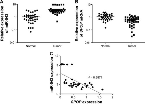 Figure 1 Expression of miR-543 and SPOP in GC tissues. (A) qPCR analysis of miR-543 expression level in tissues. Relative miR-543 expression in 36 paired GC tissues (Tumor) and adjacent non-tumor tissues (Normal) (P<0.001). (B) qPCR analysis of the relative expression of SPOP in 36 GC tissues (P<0.001). (C) Inverse correlation between miR-543 and SPOP in GC tissues. miR-543 level was normalized to the U6 level, and the SPOP level was normalized to the β-actin level. Correlation was statistically analyzed using Pearson’s correlation coefficient analysis. Data represent mean ± SD.
