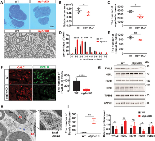 Figure 2. Atg7-deficiency in DRG neurons induced peripheral axon degeneration. (A) Semithin sections and FE-SEM of the sciatic nerves of WT and Avil-atg7-cKO mice in adults. Scale bar: 100 μm. (B) Measurement of the sciatic nerve areas in semithin sections from WT and Avil-atg7-cKO mice. (C, D) Counting the number and the measurement of axon diameter of myelinated fibers in FE-SEM images of the sciatic nerve. (E) the number of Remak bundles in the sciatic nerve. (F) IF staining against CALC and parvalbumin (PVALB) in the sciatic nerve of WT and Avil-atg7-cKO mice, and the number of Parvalbumin (+) axons in the sciatic nerve section in adults. Scale bar: 50 μm. (G) Western blot analysis showing the levels of Parvalbumin, neurofilament (NF) and beta-tubulin in the sciatic nerve of WT and Avil-atg7-cKO mice. The graph shows quantitative analysis on the western blot. n = 3. (H) The morphology of the Band of Büngner (BB) in the sciatic nerve of Avil-atg7-cKO mice. FB; fibroblast, MA; myelinated axon. (I) Counting the number of BB in the sciatic nerve. *; p < 0.05, **; p < 0.01, ***; p < 0.001, ****; p < 0.0001.