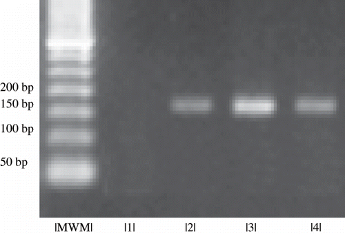 Figure 1. mtDNA for analysis of 4977bp deletion in DNA isolated from blood cell. Image of PCR products by agarose gel electrophoresis. Column 1 is a sample from a patient with normal mtDNA; columns 2–4 present the 160bp band, indicating the presence of mtDNA 4977bp deletion. MWM is the molecular weight marker.