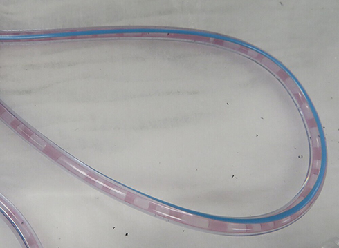 Figure 6 Multiple clogging of the purple colored silicone oil in the suction tube.