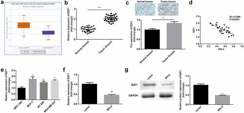 Figure 4. Upregulation of E2F1 was observed in breast cancer. (a) RPL5 expression data were acquired from StarBase database. (b) E2F1 mRNA expression levels were determined in paired tumor tissues and para-carcinoma tissues (n = 30) by qPCR. (c) E2F1 expression was detected in normal and tumor tissues using IHC assay. (d) The correlation between E2F1 and RPL5. (e) E2F1 mRNA expression levels were determined using qPCR in MCF-10A, MCF-7, BT-549, and MDA-MB-231 cells. (f) The mRNA expression levels of E2F1 after overexpressing RPL5 were estimated by qPCR. (g) The protein levels of E2F1 were measured by western blotting. **P < 0.01. ***P < 0.001.