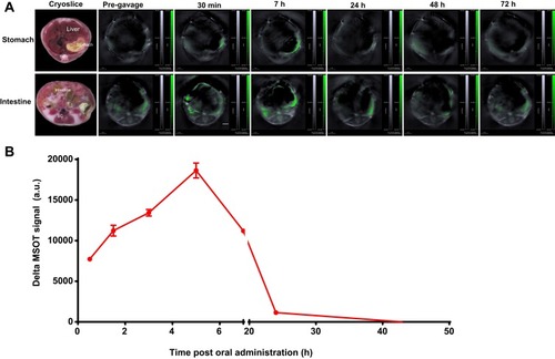 Figure 3 Biodistribution of SWCNHs following oral administration. (A) MSOT single cross-sectional images showing stomach and intestines, in which the spectrally unmixed SWCNHox component was superimposed on the greyscale scale 800 nm single wavelength image of a mouse, given a single dose of 200 µg. Images of cryoslices were used as anatomical references. (B) The plot of the corresponding delta MSOT signal in the stomach drawn using MSOT signal of the corresponding time points subtracted the background signal (Pre-gavage).