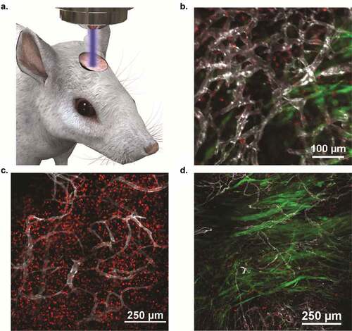 Figure 4. Intravital imaging confirmed increased CAR T-cell expansion and extravasation following RT, leading to rapid tumor clearance within 5 days. SB28 GD2+cells transfected to express GFP were orthotopically engrafted in C57BL/6 mice and were treated 10 days following tumor implantation with either 1 × 10Citation7 GD2 CAR T-cells and RT or 1 × 10Citation7 GD2 CAR T-cells alone. All adoptively transferred T-cells were derived from tdTomato mice to allow for fluorescent monitoring. (a) Visual schematic of intravital imaging shows the physical orientation of dynamic and longitudinal in vivo monitoring via a surgically implanted window chamber. (b) Intravital imaging 24 hours after treatment visualized CAR T-cell extravasation from the vasculature following whole body irradiation. (c). Intravital imaging of tumor-bearing mice 5 days following WBI and CAR T-cells revealed expansive CAR T-cell proliferation and corresponding tumor regression. (d). Imaging tumor-bearing mice 5 days following CAR T-cell treatment without WBI revealed inferior penetration within the tumor bed, leading to suboptimal therapeutic response as compared to CAR T-cells and WBI treatment. For B-D, fluorescent imaging shows SB28 GD2+ tumor cells (green), GD2 CAR T-cells (red), and tumor vasculature (white).