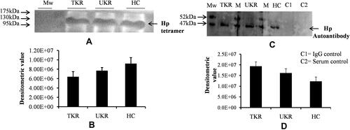 Figure 4 Native-gel analysis and autoantibody detection against haptoglobin (Hp). (A) Representative glycoprotein-stained image of Western blot after running native PAGE using purified native Hp protein (tetramer) by immunoprecipitation from plasma samples indicated low levels of Hp tetramer (120 kDa) in TKR and UKR compared to HCs. (B) Densitometric analysis of glycosylated Hp native band shows lower levels of Hp tetramer in TKR (0.69-fold) and UKR (0.83-fold) than HCs. (C) Western blot was carried out after running SDS-PAGE using IP-eluted purified Hp protein and using blood plasma as source of primary antibodies followed by incubation with antihuman secondary antibody. The image represents increased levels of autoantibodies against Hpβ in TKR and UKR plasma compared to HCs. (D) Densitometric analysis of Western blot indicating subsequent increased level of autoantibodies (1.57-fold in TKR and 1.31-fold in UKR) against Hpβ compared to HC plasma samples.