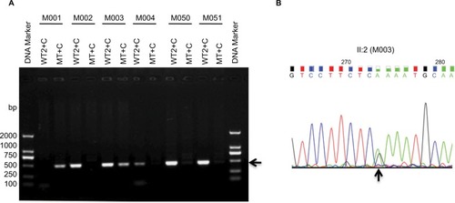 Figure 3 ARMS amplification by primers CHM-WT2 (WT2) and CHM-Common, and primers CHM-MT and CHM-Common.