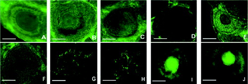 Figure 1. In vivo and in vitro observation of BMP-6 expression in follicles. BMP-6 expression was observed by immunofluorescence. In vivo expression of BMP-6 in primary follicles on day 14 (A), day 20 (B) and day 24 (C). In vivo expression of BMP-6 in the secondary follicles on day 14 (D), day 20 (E) and day 24 (F). In vitro expression of BMP-6 in granulosa cells from follicles on day 6 (G) and day 10 (H). In vitro expression of BMP-6 in the COC from follicles on day 6 (I) and day 10 (J). Bar = 100 μm.