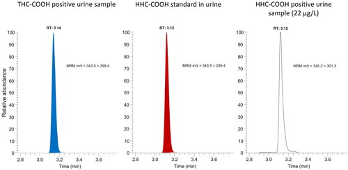 Figure 2. Chromatograms showing a patient urine sample testing positive for the carboxylic acid metabolite of delta-9-tetrahydrocannabinol (THC-COOH), a spiked urine standard for hexahydrocannabinol carboxylic acid (HHC-COOH), and a patient urine sample testing positive for HHC-COOH (22 µg/L).