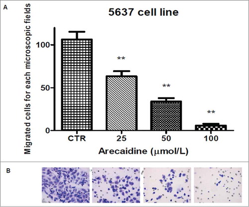 Figure 8. The M2 agonist Arecaidine inhibits in vitro cell migration of 5637 cell line. (A) Graph showing that 25, 50 and 100 μM of Arecaidine were able to significantly decrease the number of migrated cells. (B). Representative microscopic fields of 5637 cell migration across an 8 μm pore size filter in absence and in presence of 25, 50 and 100 μM Arecaidine for 21 hours. Magnification 25×. The bars represent the mean ± SD. **P < 0.01 vs. untreated cells. CTR, control.