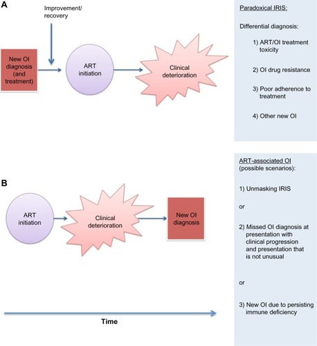 Figure 1 Schematic demonstrating sequence of key events in paradoxical immune reconstitution inflammatory syndrome (IRIS) (A) and unmasking IRIS (B).