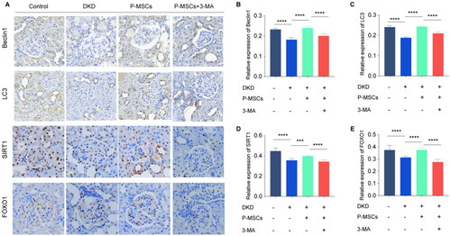 Figure 3. Effects of placenta-derived mesenchymal stem cells (P-MSCs) and 3-methyladenine (3-MA) on autophagy-related proteins, SITR1 and FOXO1 in renal tissue of diabetic kidney disease (DKD) rats. A: Expression of autophagy-related proteins Beclin1, LC3, SITR1, and FOXO1 was evaluated by immunohistochemical staining in renal tissue of rats in each group; B: Effects of P-MSCs and 3-MA on Beclin1 in renal tissue of DKD rats; C: Effects of P-MSCs and 3-MA on LC3 in renal tissue of DKD rats D: Effects of P-MSCs and 3-MA on SITR1 in renal tissue of DKD rats; E: Effects of P-MSCs and 3-MA on FOXO1 in renal tissue of DKD rats. (***p < 0.001,****p < 0.0001).