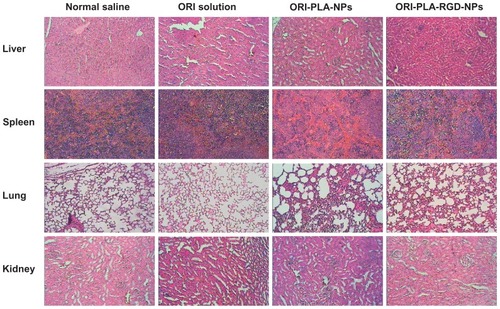 Figure 8 Representative images of hematoxylin and eosin-stained tissue sections from tumor-bearing mice treated with normal saline, oridonin (ORI) solution, ORI-loaded atactic poly(D,L-lactic acid) nanoparticles (ORI-PLA-NPs), or ORI-PLA-NPs further modified by surface cross-linking with the peptide Arg-Gly-Asp (ORI-PLA-RGD-NPs) (magnification 40×).