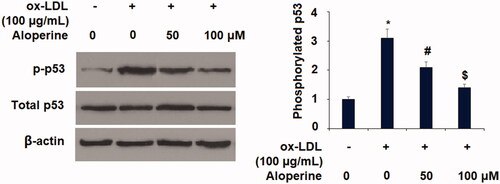 Figure 8. Aloperine mitigated ox-LDL-induced activation of p53 in HUVECs. Cells were cultured with ox-LDL (100 µg/mL) with or without aloperine (50,100 μM) for 2 h. Phosphorylated and total levels of p53 were assayed (*, p < .01 vs. vehicle group; #, p < .01 vs. ox-LDL treatment group; $, p < .01 vs. ox-LDL + 50 μM aloperine group).
