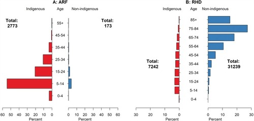 Figure 2 Age distribution of cases at time of initial (A). Acute rheumatic fever (ARF) and (B). Rheumatic heart disease (RHD) diagnoses, by Indigenous status (2001–2017, mid-year).