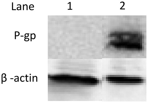 Figure 7. P-glycoprotein expression in SKOV3, SKOV3TR cells using western blot analysis. Lane 1: SKOV3 cells (20 µg protein lysate), Lane 2: SKOV3TR cells (20 µg protein lysate). β-actin was used as a loading control.