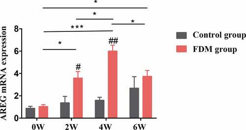 Figure 1. Expression of AREG mRNA in the posterior sclera by RT-PCR. AREG mRNA expression in FDM group was upregulated in 2 W, 4 W and slightly decreased after 2 weeks of recovery (6 W) (all p < .05), while no significant difference was found in AREG expression at different time points in control groups (all p > .05); AREG mRNA expression in FDM group was higher than that in control group in 2 W and 4 W (p = .036 and p < .001) but not in 0 W (p = .544) or 6 W (p = .364). AREG expression was normalized to GAPDH (n = 4); *p < .05 and ***p < .001: comparison between the two group, #p < .05 and ##p < .05 compared with the control group at the same time-point