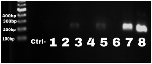 Figure 2 Gel electrophoresis for nuc gene to determine the prevalence of S. aureus. The band size was 279 bp; sample 8 was the positive control. Samples 3, 5, and 7 were considered as positive clinical samples.