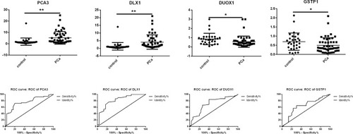 Figure 3 Clinical validation of candidate biomarkers of PCa. PCA3, DLX1, DUOX1, and GSTP1 plasma mRNA expression in PCa compared with normal controls (Top); corresponding ROC analysis of PCA3, DLX1, DUOX1, and GSTP1 plasma mRNA expression in PCa (Bottom). *P < 0.05, **P < 0.01 vs control.