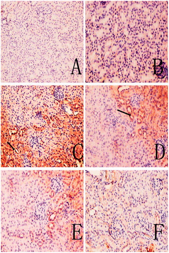 Figure 6. C5b-9 deposition in mouse renal tissue. (A) Control; (B) solvent control; (C) TCE+. (D) TCE−. (E) PDTC+. (F) PDTC−. Black arrows indicate C5b-9 deposition. Magnification = 200X.