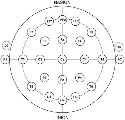 Figure 1 Electrode placement. This figure is a visual representation of the electrode placement used according to the 10–20 system of electrode placement.