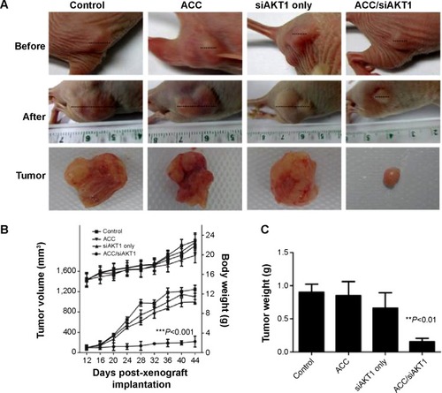 Figure 6 Tumor growth in vivo after intratumoral injections of ACC/CaIP6/siAKT1 nanoparticles.Notes: (A) Representative tumors before and after injection. (B) ACC/CaIP6/siAKT1 (20 µg siAKT1/injection, 50:1 mass ratio) was locally injected into the tumors (100 mm3 in volume at 12 days). Tumor diameter was measured using calipers and tumor volume was calculated using the following formula: volume = W2 × L/2, where W is the width of the tumor and L is the tumor length. Results are presented as the mean ± standard deviation (n=7 per group; ***P<0.001 versus other groups). (C) Mean tumor weight (± standard deviation) after mice were sacrificed (n=7 per group; **P<0.01 versus other groups).Abbreviations: ACC, amorphous calcium carbonate; ACC/CaIP6, amorphous calcium carbonate hybrid nanospheres functionalized with a Ca(II)-inositol hexakisphosphate compound; siAKT1, small interfering AKT1.